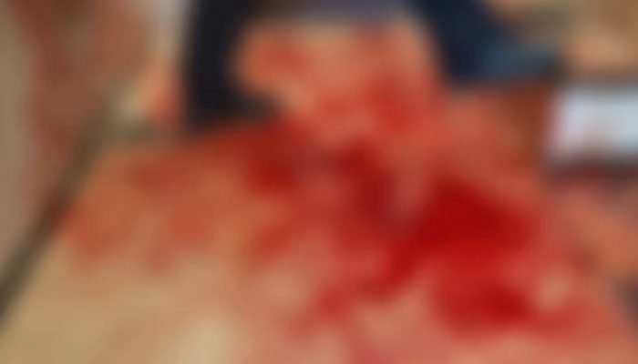 Uma mulher com mandado de prisão em aberto, ficou gravemente ferida - Foto: Divulgação/Polícia Civil